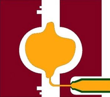 injection-caoutchouc-compression injection caoutchouc compression